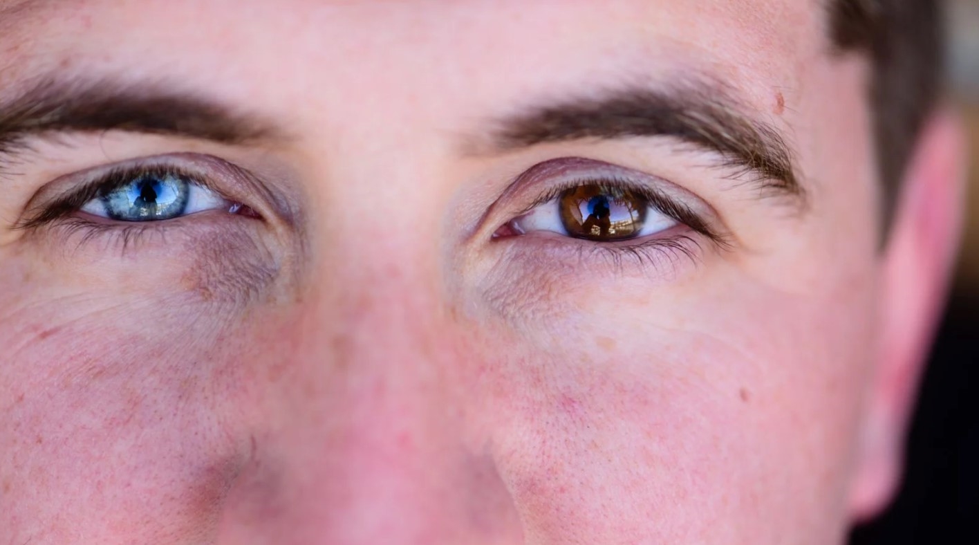 What Makes Colored Contact Lenses Look Natural